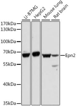 S100A11 Rabbit anti-Human, Polyclonal, Novus Biologicals 100 &mu;L; Unconjugated:Antibodies,